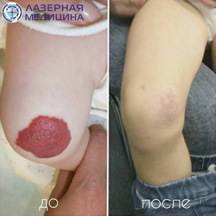 Лечение в калининграде