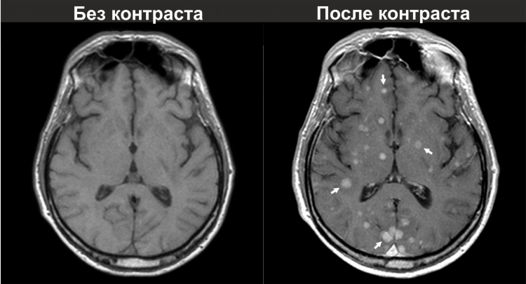 Мрт калининград донского